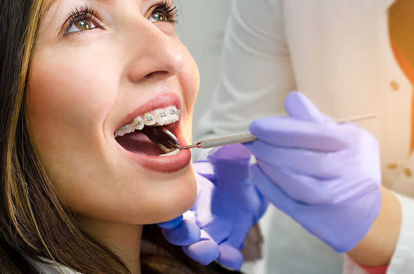 Closeup of beautiful girl on dental braces check up