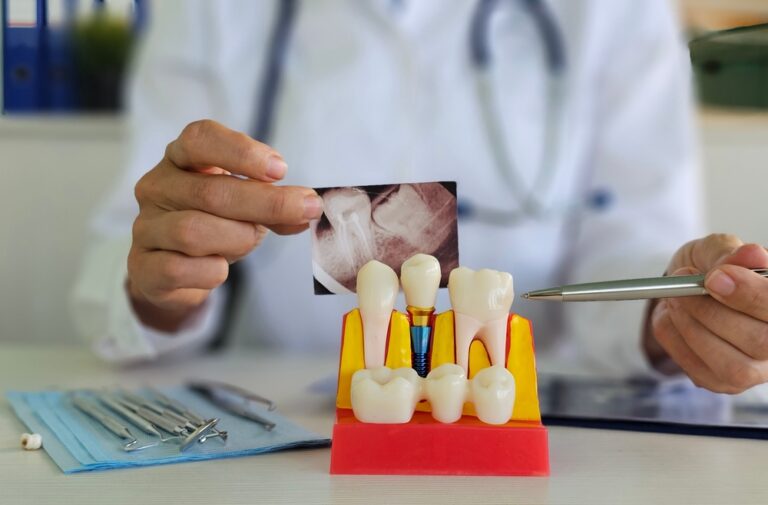 A dentist is carefully placing a titanium dental implant into a patient's jawbone. The image should convey precision and advanced dental technology. No text on the image.