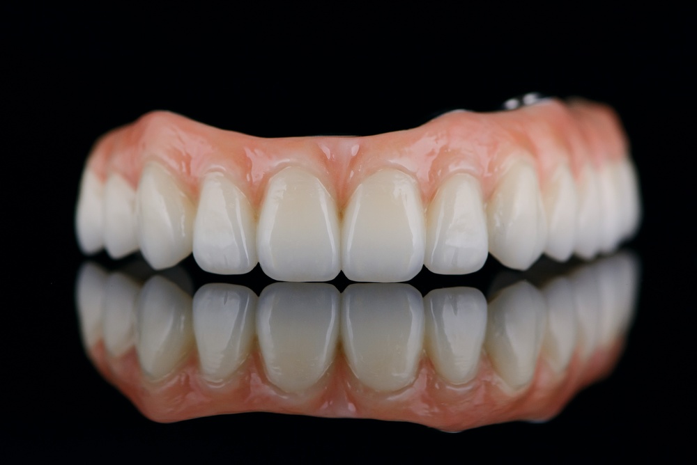 What Is Implant Dentures? Cost, Procedure, and Benefits