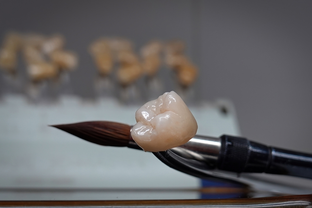 Crown vs Veneer: Which is Right for Your Smile?